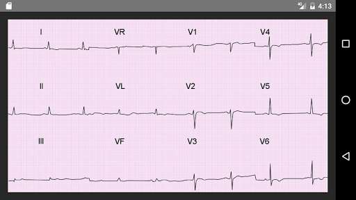 Play APK ECG 100 Clinical Cases  and enjoy ECG 100 Clinical Cases with UptoPlay com.doctor.ecgclinicalcases