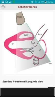 Play EchoCardioPro 