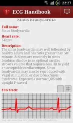 Play Heart ECG Handbook - Lite Play Heart ECG Handbook - Lite