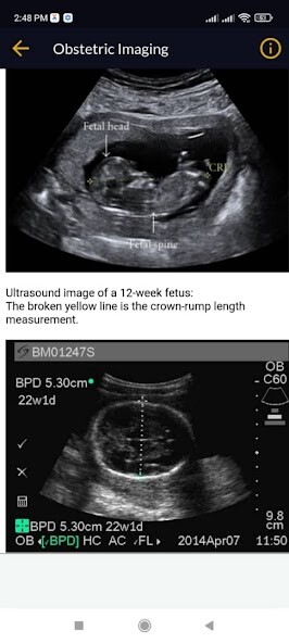 Play APK Obstetrics  and enjoy Obstetrics with UptoPlay com.Doctor.obstetrics