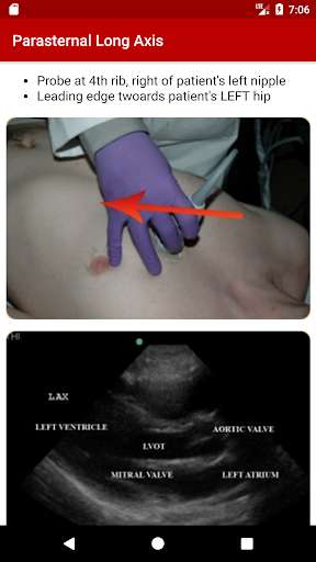 Play APK POC Ultrasound Guide  and enjoy POC Ultrasound Guide with UptoPlay edu.osumc.craigkey.poc_us