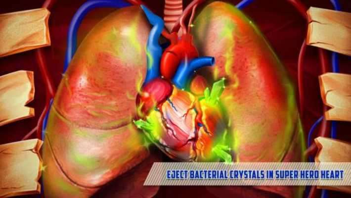 Play Super Hero Open Heart Surgery 