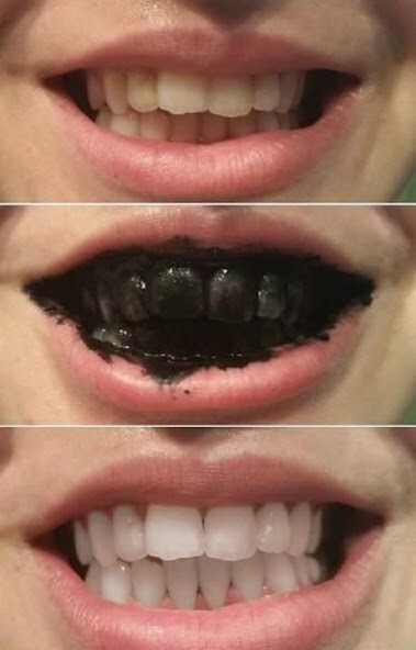 Play APK Teeth Whitening Tips  and enjoy Teeth Whitening Tips with UptoPlay com.HealthAndFitnessGuide.TeethWhiteningTips