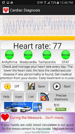 Play APK Cardiac diagnosis (arrhythmia)  and enjoy Cardiac diagnosis (arrhythmia) with UptoPlay com.sdk.blood_pressure