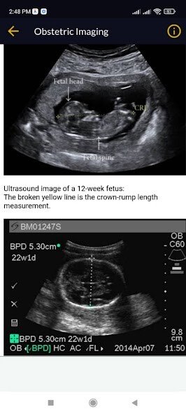 Play APK Obstetrics  and enjoy Obstetrics with UptoPlay com.Doctor.obstetrics
