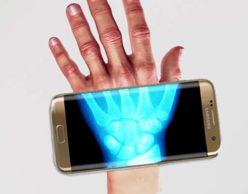 Play Xray Radiology Scanner Play Xray Radiology Scanner