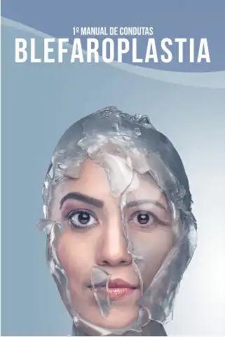 Play 1º Condutas de Blefaroplastia as an online game 1º Condutas de Blefaroplastia with UptoPlay