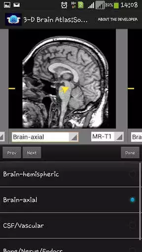 Play APK 3-D brain Atlas and enjoy 3-D brain Atlas with UptoPlay com.soham.android.mi.brainimage Play APK 3-D brain Atlas and enjoy 3-D brain Atlas with UptoPlay com.soham.android.mi.brainimage
