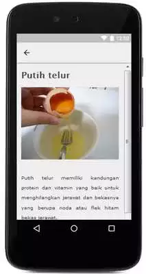 Play 50 Cara menghilangkan jerawat