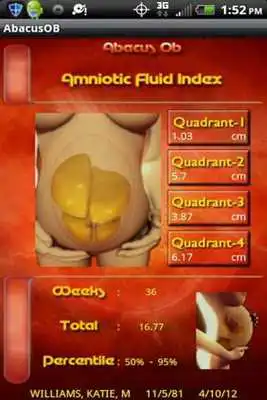 Play Abacus OB Prime - Standard