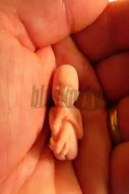 Play Abortion