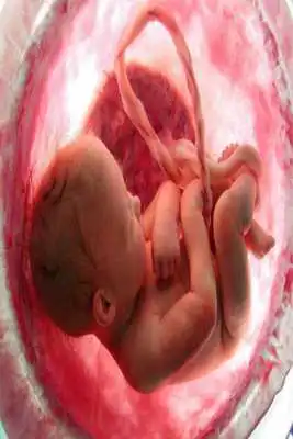 Play Abortion