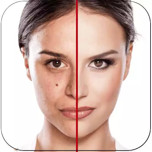 Free play online Acne Free : Pimple Remover APK Free play online Acne Free : Pimple Remover APK