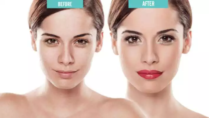 Play Acne Free : Pimple Remover