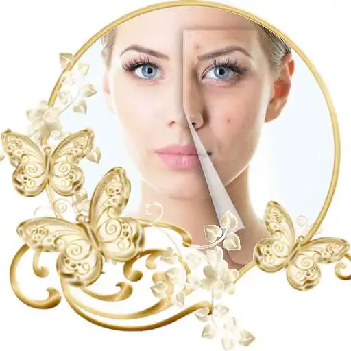 Play Acne Scars Remedies APK