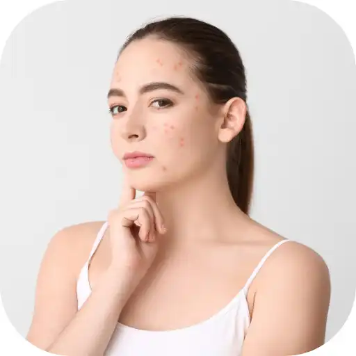 Play acne treatment for teens APK Play acne treatment for teens APK