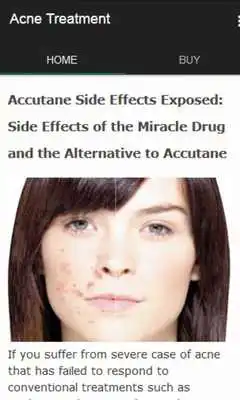 Play Acne Treatment