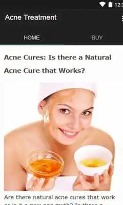Play Acne Treatment