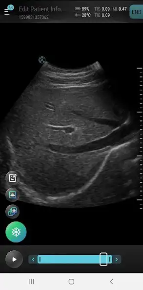 Play Aco Smartcare Apache Ultrasound App  and enjoy Aco Smartcare Apache Ultrasound App with UptoPlay