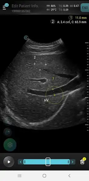 Play Aco Smartcare Apache Ultrasound App as an online game Aco Smartcare Apache Ultrasound App with UptoPlay