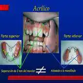 Free play online Activador de Frankel APK