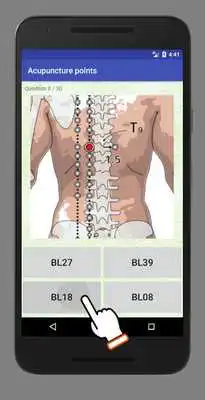 Play acupuncturepoint trial Play acupuncturepoint trial