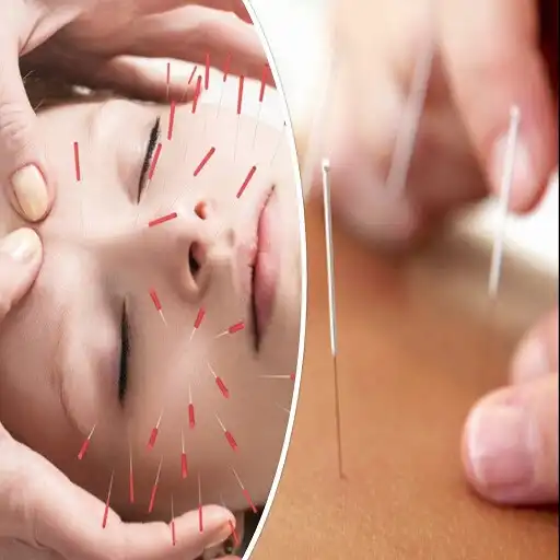 Play Acupuncture Tips APK