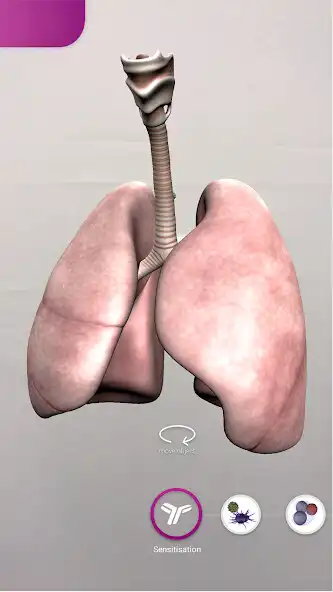 Play Allergic Asthma  and enjoy Allergic Asthma with UptoPlay