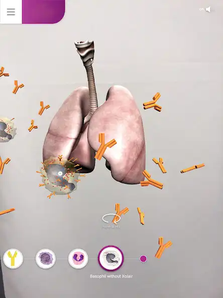 Play Allergic Asthma as an online game Allergic Asthma with UptoPlay