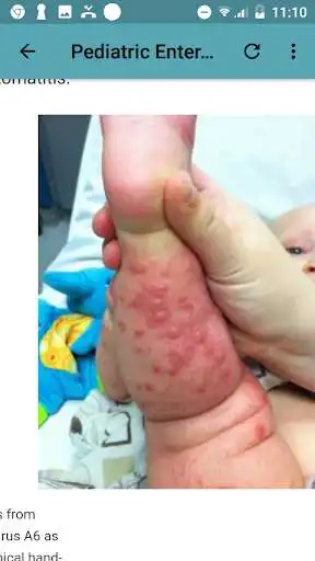 Play All Pediatric Diseases as an online game All Pediatric Diseases with UptoPlay