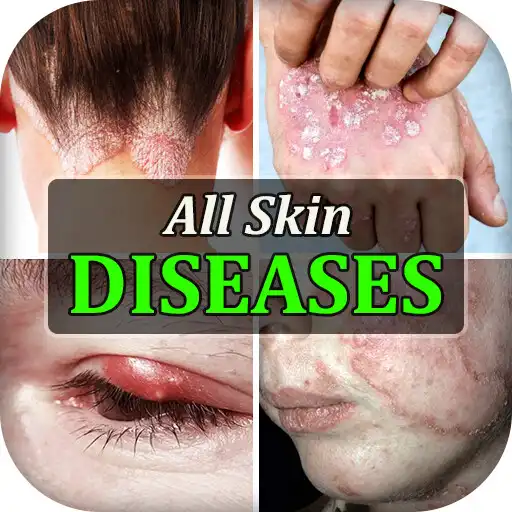 Play All Skin Diseases Treatment APK Play All Skin Diseases Treatment APK