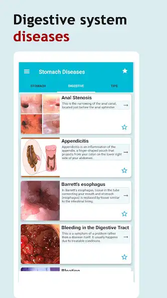 Play All Stomach Disease Treatment  and enjoy All Stomach Disease Treatment with UptoPlay