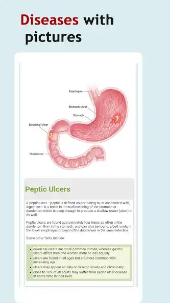Play All Stomach Disease Treatment as an online game All Stomach Disease Treatment with UptoPlay