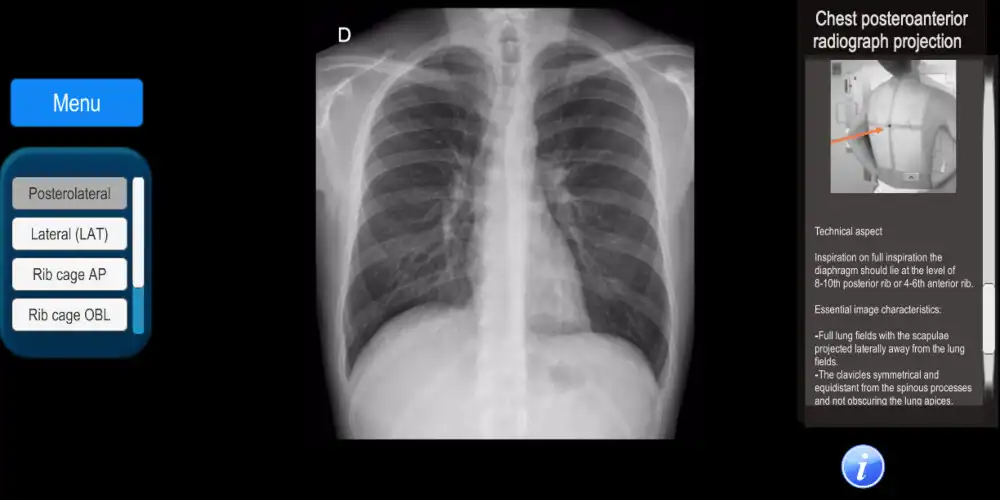 Playing Radiographic Anatomy and Radiographic Projections online game with UptoPlay