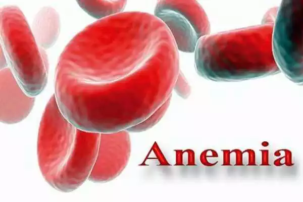 Play Anemia