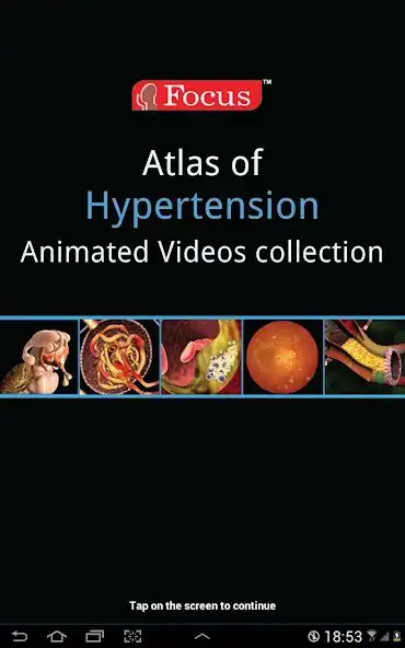 Play Animated Atlas of Hypertension  and enjoy Animated Atlas of Hypertension with UptoPlay