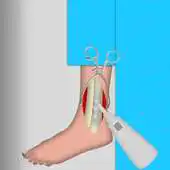 Free play online ankle surgery games APK