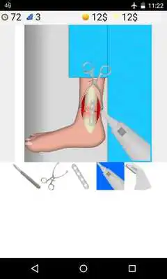 Play ankle surgery games