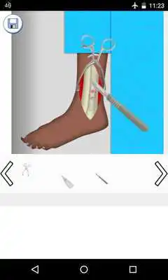 Play ankle surgery games
