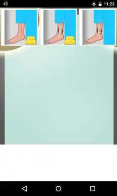 Play ankle surgery games