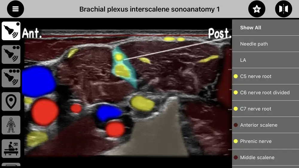 Play AnSo Anaesthesia Sonoanatomy  and enjoy AnSo Anaesthesia Sonoanatomy with UptoPlay