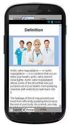 Play Aortic Valve Regurgitation