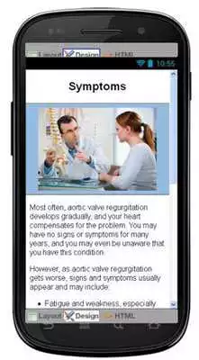 Play Aortic Valve Regurgitation