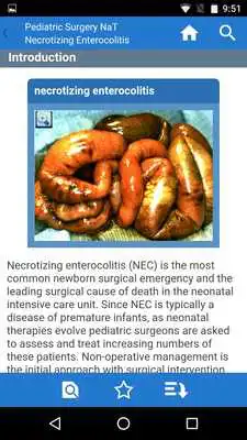 Play APSA Pediatric Surgery Library