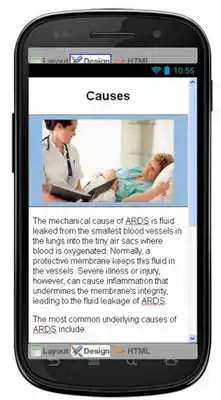 Play Ards Disease Symptoms Play Ards Disease Symptoms