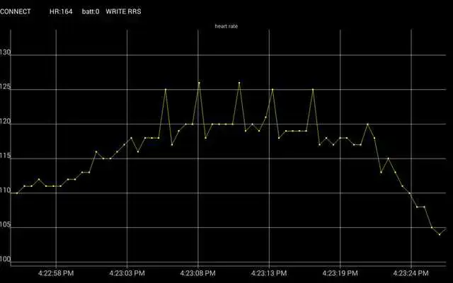 Play Arrhythmia monitor open source Play Arrhythmia monitor open source