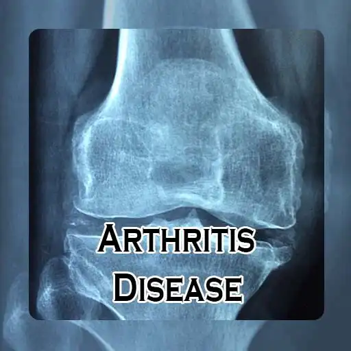 Play Arthritis Disease: Causes, Dia APK Play Arthritis Disease: Causes, Dia APK