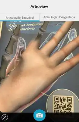 Play Artroview Play Artroview