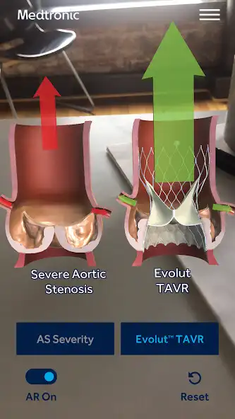 Play AS TAVR Education  and enjoy AS TAVR Education with UptoPlay