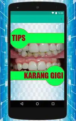 Play atasi karang gigi alami